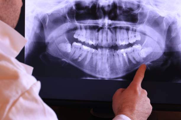 Best Walk-In Emergency Dental Services in Stanton, TX