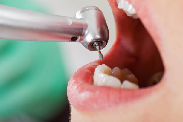 Best Emergency Pediatric Dental Care in Stanton, TX